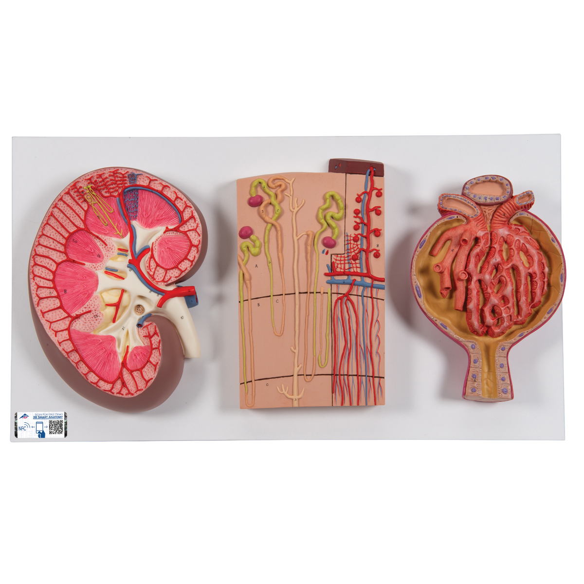 Sectiune prin rinichi, nefron, vase sanguine si corpuscul renal, material didactic biologie